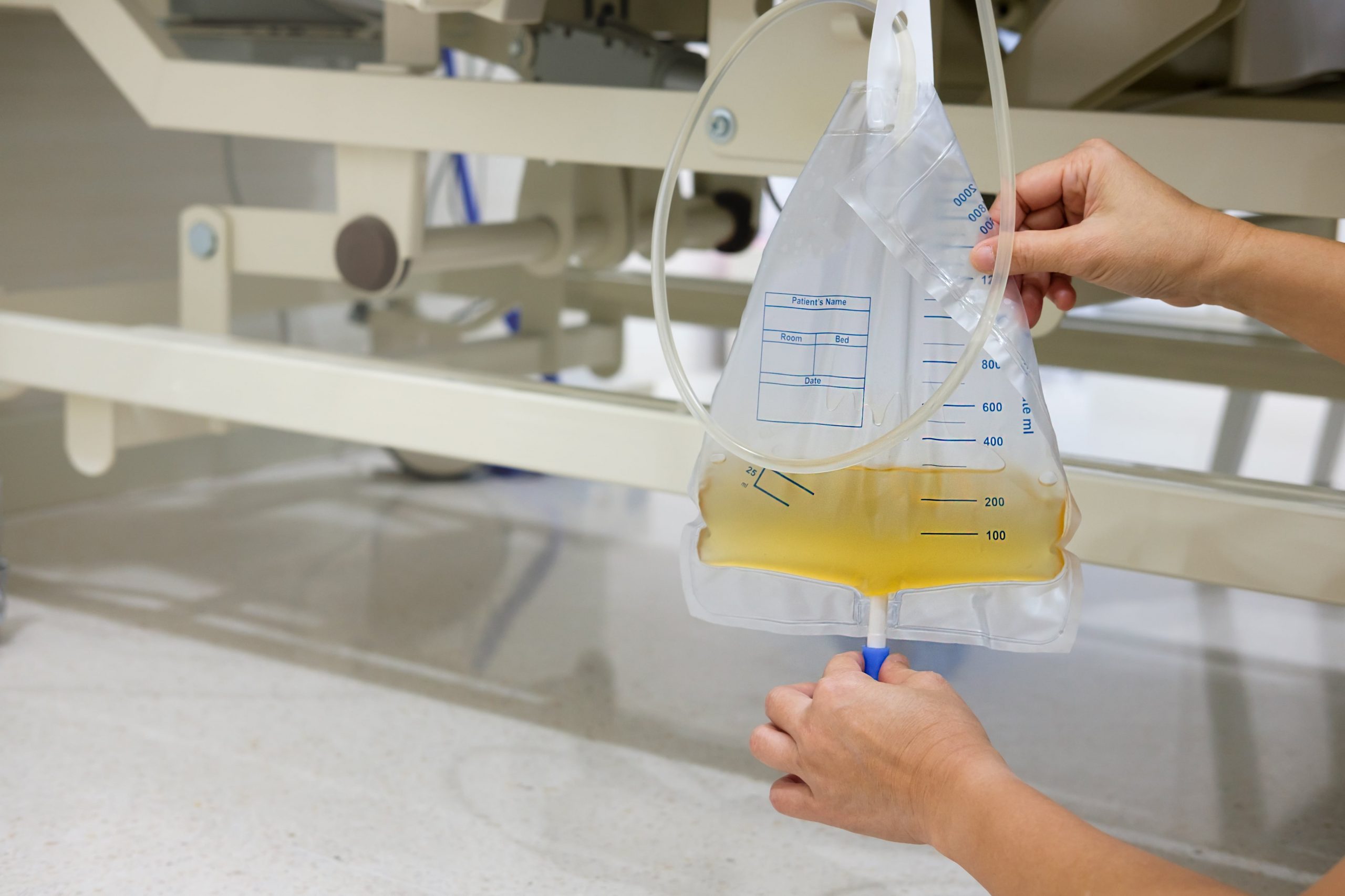 Evde İdrar Sondası Çıkartılması shutterstock_791774875-min